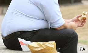 Obesity in the UK: Time to tackle it?