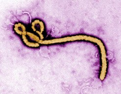 Ebolavirus: Jeder Sechste hält Ausbruch in Deutschland für wahrscheinlich