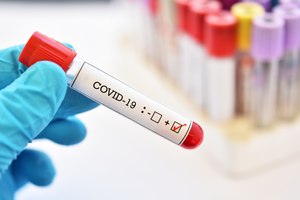 80% Indians want the government to expand the Coronavirus testing capacity 
