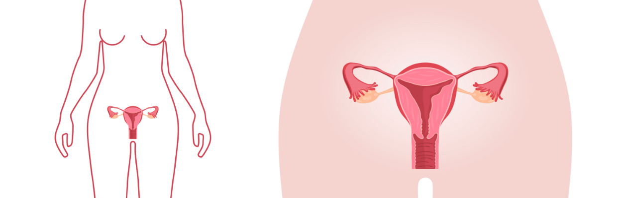 Vagina spirale Mirena (IUD)